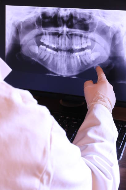 Best Knocked-Out Tooth (Avulsed Tooth) Treatment in Ukiah, CA